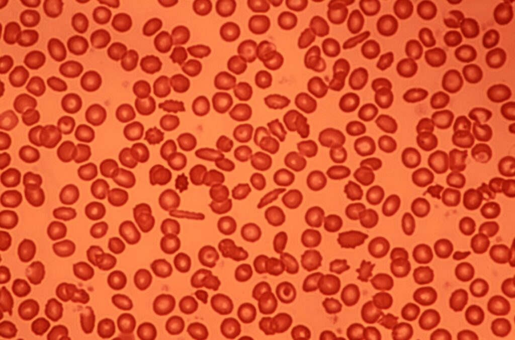 Blood Cells under a microscope