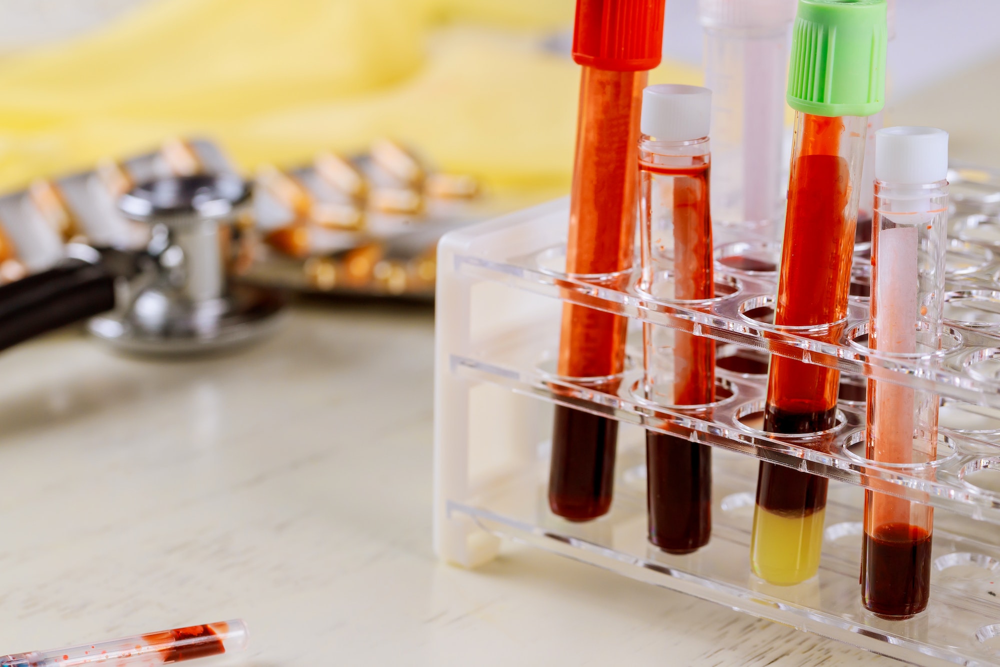 Medical working with blood sample a medical clinic laboratory
